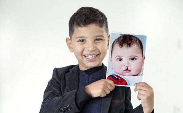 UAE: Free life-changing surgeries help children smile bright this Eid Al Fitr